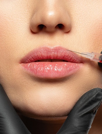 Bella Medspa is the best injectables spa in Alpharetta and Buckhead